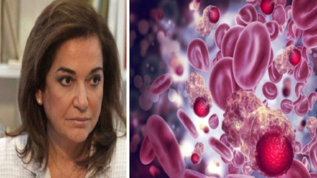 Τι είναι το πολλαπλό μυέλωμα – Ο τύπος καρκίνου που διαγνώστηκε η Ντόρα Μπακογιάννη