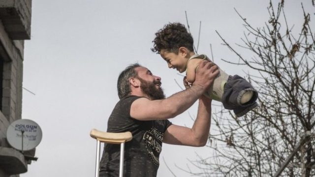 Συγκλονίζει η φωτογραφία της χρονιάς: Ο ακρωτηριασμένος πατέρας και το παιδί του