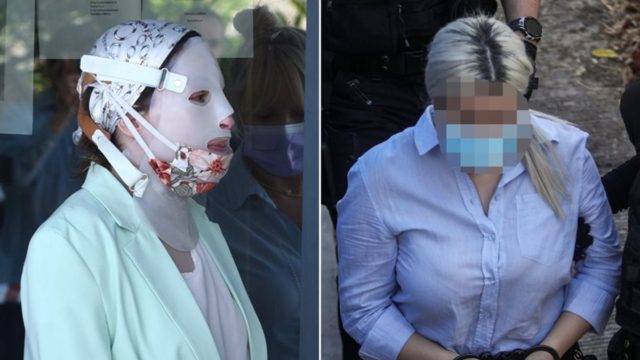 Επίθεση με βιτριόλι: «Η Ιωάννα ζει από θαύμα – Περιμένει ποινή που θα τη βοηθήσει να αντιμετωπίσει τα δικά της ισόβια»