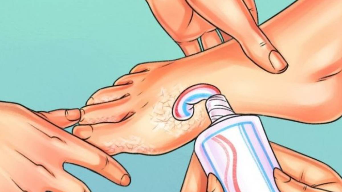 Παίρνει μαγειρική σόδα και οδοντόκρεμα και αλείφει τα πόδια της! Το απότελεσμα; Απίστευτο