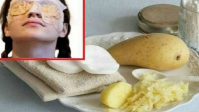 Αναμειγνύει πατάτα, μέλι και ελαιόλαδο και το απλώνει κάτω από τα μάτια της – Το αποτέλεσμα; Απίθανο!