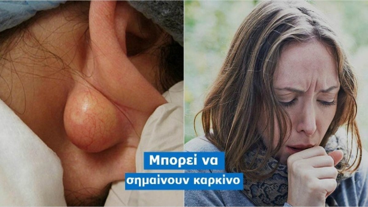 9+1 προειδοποιητικά σημάδια στο σώμα σας που δείχνουν ότι μπορεί να έχετε καρκίνο – Προσοχή στο 4ο!