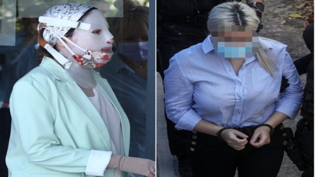 Επίθεση με βιτριόλι: Το στοιχείο που φέρνει την ανατροπή!