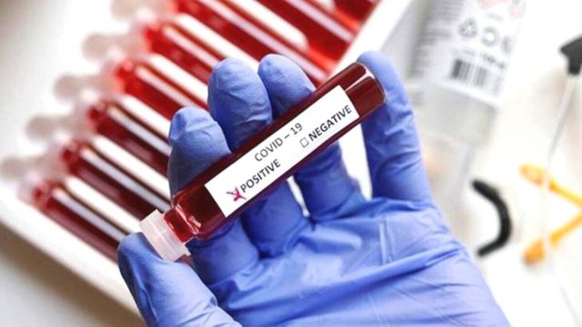Κορωνοϊός: 7.317 νέα κρούσματα σήμερα στην Ελλάδα – 63 θάνατοι και 556 διασωληνωμένοι