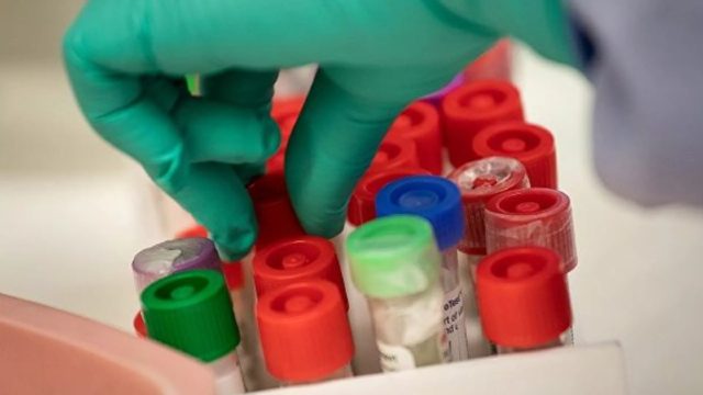 Κορωνοϊός: Νέα ανακάλυψη με γονίδιο που ενδέχεται να αυξάνει τον κίνδυνο θανάτου – Ποιοι το έχουν
