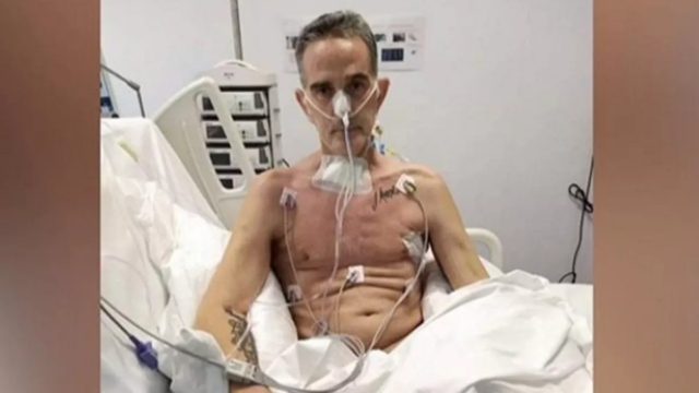 Βασίλης Μοϊντίνης: Ο αθλητής του bodybuilding έχασε 42 κιλά μετά από 2 μήνες στην ΜΕΘ – Σοκάρει η εικόνα του