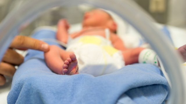 Σοκ στη Βραζιλία: Γεννήθηκε μωρό με ουρά 12 εκατοστών (photos)