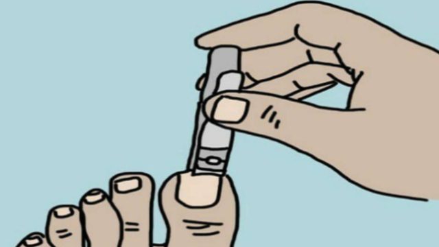Έχετε πρόβλημα; Τα νύχια των ποδιών σας μπαίνουν μέσα στο δέρμα; Ακολουθήστε τις παρακάτω συμβουλές!