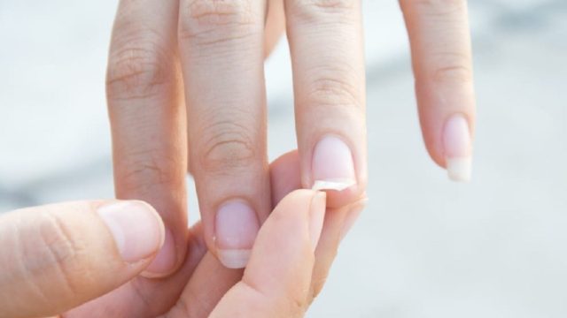 Έχετε παρατηρήσει να σπάνε τα νύχια σας; Αυτό μπορεί να σημαίνει…