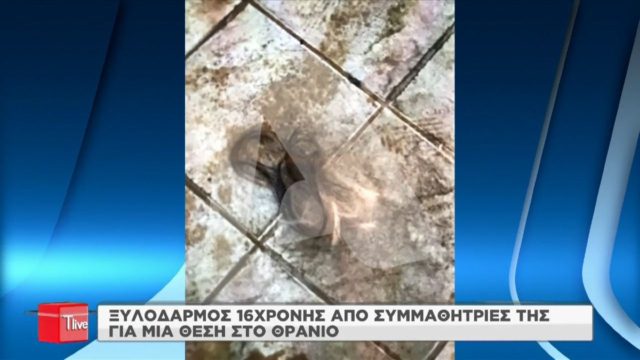Ζωγράφου: Εικόνα με τούφες μαλλιών μετά το ξύλο 16χρονης με συμμαθήτριες – Τι καταγγέλλει η μητέρα