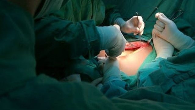 Είχε στομαχόπονο και κατέληξε στο νοσοκομείο – Αυτό που αντίκρυσαν δεν το πίστευαν
