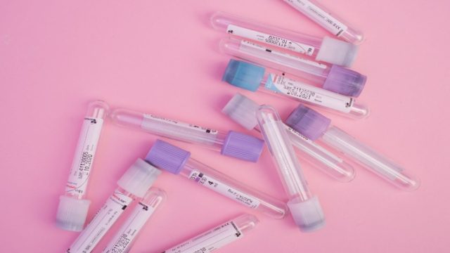 Απίστευτο: Εργαστήριο έδωσε λανθασμένη διάγνωση κορωνοϊού σε εκατοντάδες άτομα
