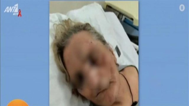 Αποκλειστική νοσοκόμα ξυλοκόπησε ηλικιωμένη! Τι λέει η κόρη της – Συγκλονίζουν οι εικόνες (Video)