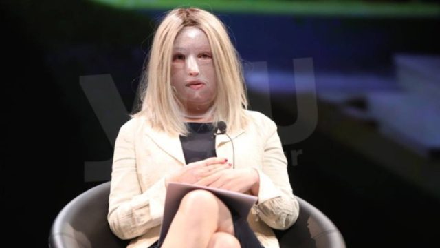 Ήταν ξαφνική ανατροπή: Αυτά είπαν οι Γάλλοι γιατροί στην Ιωάννα Παλιοσπύρου!