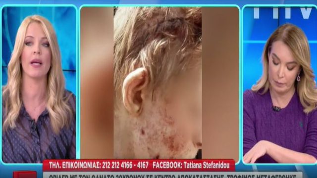 Θάνατος 20χρονου στην Θεσσαλονίκη: Οργή και ερωτήματα από την οικογένεια – Εικόνα ντοκουμέντο με τα βαριά τραύματα (video)