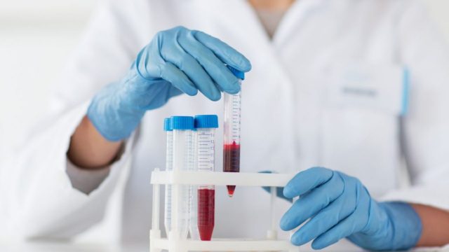 Επαναστατικό τεστ για τον καρκίνο – Μελάνωμα: Προβλέπει με ακρίβεια αν είναι πιθανό να εξαπλωθεί