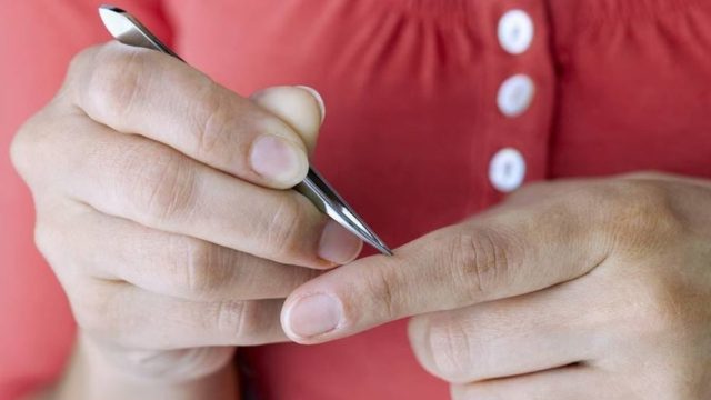 Σας μπήκε ακίδα στο χέρι; Έτσι θα την βγάλετε με ασφάλεια