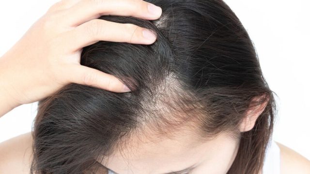 Νιώθετε ότι σας πέφτουν τρίχες και ότι αραιώνουν τα μαλλιά σας; Να τι πρέπει να κάνετε για να σωθείτε
