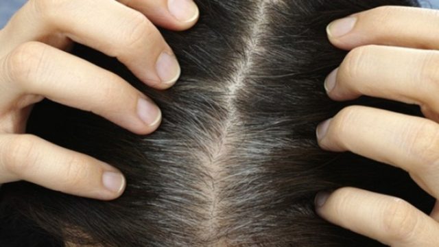 Άσπρισαν πρόωρα τα μαλλιά σας; Τι σημαίνει για την υγεία σας και τι πρέπει να κάνετε