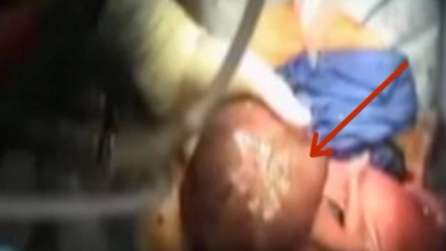 Έγκυος πήγε στο γιατρό για να μάθει το φύλο του μωρού – Οι γιατροί «πάγωσαν» με αυτό που είδαν…