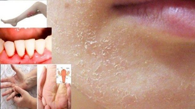Όταν το σώμα ζητά βοήθεια: 10 σημαντικά σημάδια που δεν μπορείτε να αγνοήσετε!