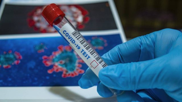 Νέα τιμή από σήμερα στα μοριακά τεστ (PCR) – «Θα είναι κοντά στα 50 ευρώ» (Video)