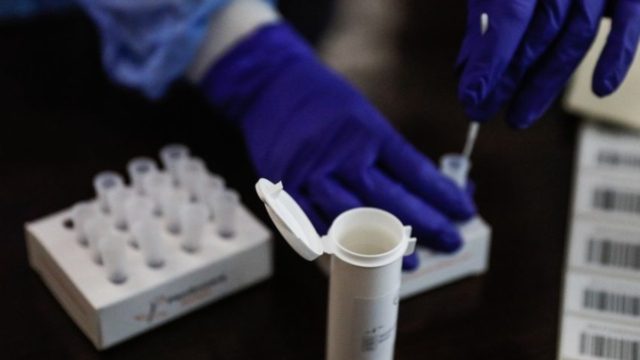 Κορωνοϊός: Με rapid test η αναρρωτική άδεια για εμβολιασμένους και ανεμβολίαστους