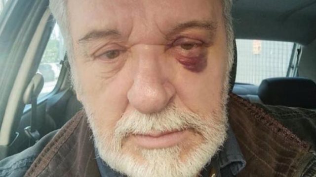 Ατύχημα για τον Τάσο Χαλκιά!