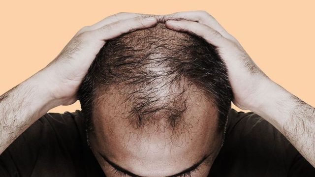 Χάνετε μαλλιά και σας ρίχνει; Δοκιμάστε αυτή τη φυσική μάσκα με ελαιόλαδο και άλλο 1 θαυματουργό υλικό