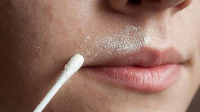 Με αυτά τα 3 υλικά θα εξαφανίσετε την ανεπιθύμητη τριχοφυΐα από το πρόσωπo!