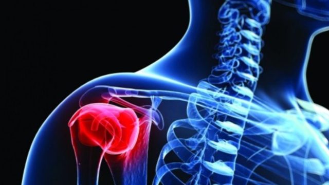 Καρκίνος στα οστά: Αυτά είναι τα ύπουλα συμπτώματα – Οι εξετάσεις που τον εντοπίζουν