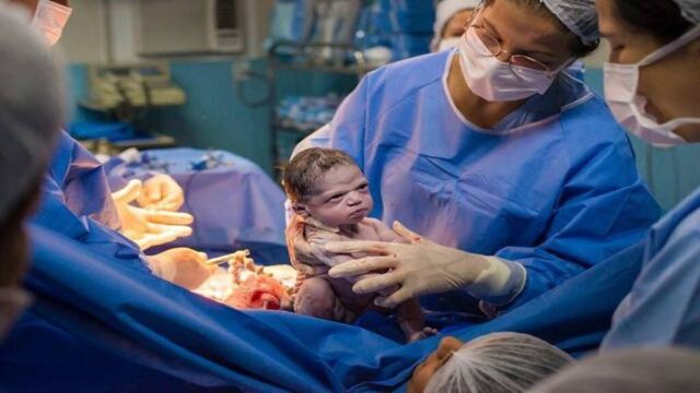 Αυτό το μωρό έγινε viral αμέσως μετά την γέννησή του – Δείτε την συγκλονιστική έκφρασή του