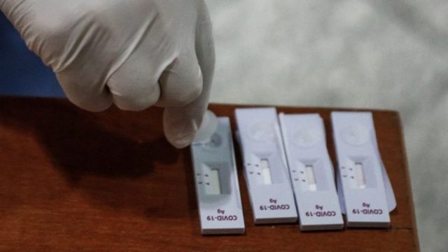 Rapid test: Ολες οι αλλαγές για τους εργαζόμενους στον ιδιωτικό τομέα