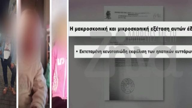 Νεκρά παιδιά στην Πάτρα: «Κλειδί στην έρευνα για τον θάνατο της Μαλένας η εξέταση του παθολογοανατόμου» – Νέες αποκαλύψεις του ιατροδικαστή Γρηγόρης Λέων