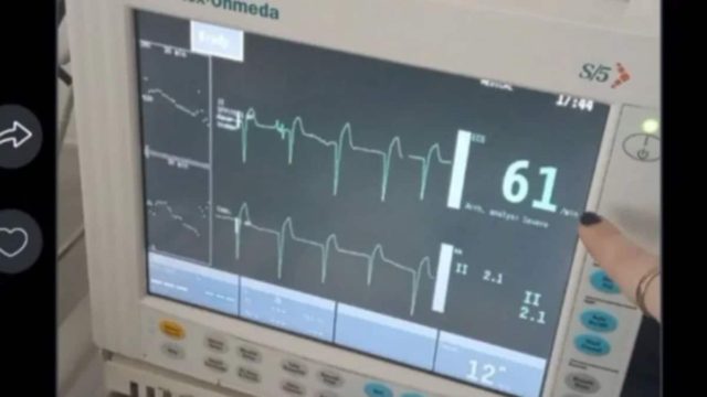 Οικογενειακή τραγωδία στην Πάτρα: Σοκάρουν τα νέα στοιχεία – «Παρέμβαση» στο σώμα της Τζωρτζίνας βλέπουν οι γιατροί