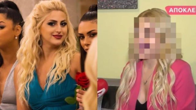 Πλαστική στη μύτη για την Έλενα Παπαμεθοδίου: Αγνώριστη 5 μήνες μετά το The Bachelor
