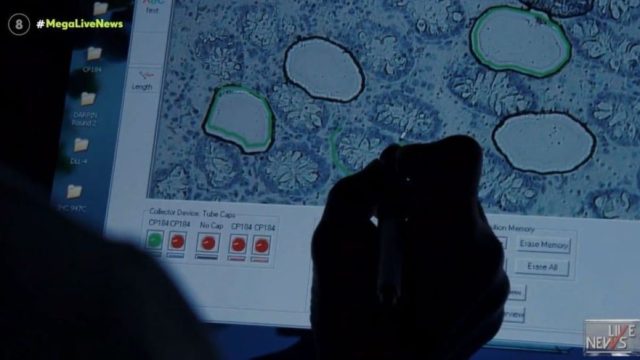 Παγκόσμιος συναγερμός: Παιδί πέθανε από οξεία ηπατίτιδα!