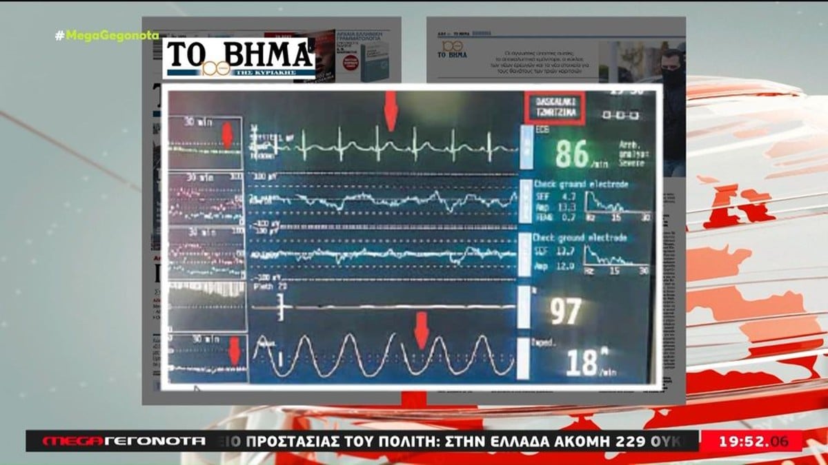 Πάτρα: Φωτογραφία ντοκουμέντο από το μόνιτορ της νοσηλείας της Τζωρτζίνας (video)