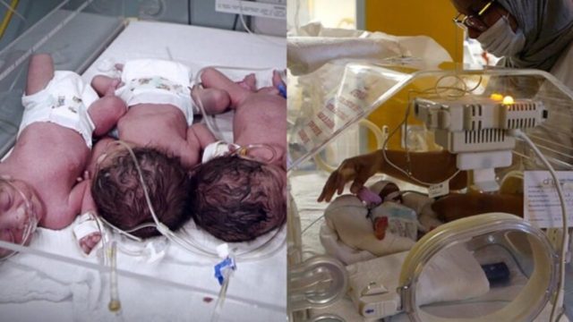 Αδιανόητο: Γυναίκα περίμενε 7δυμα και γέννησε…9δυμα