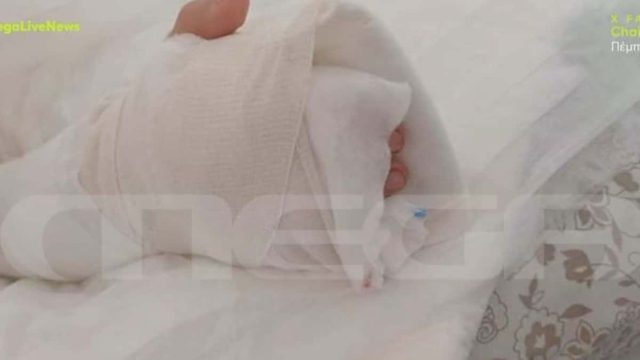 Εφιάλτης σε παιδική χαρά στη Θεσσαλονίκη: Αποκολλήθηκε το δάχτυλό 8χρονης – Συγκλονίζει η μητέρα