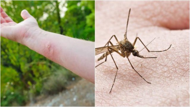 Κουνούπια τέλος! Τα 5 κόλπα που θα σε σώσουν από τα τσιμπήματα