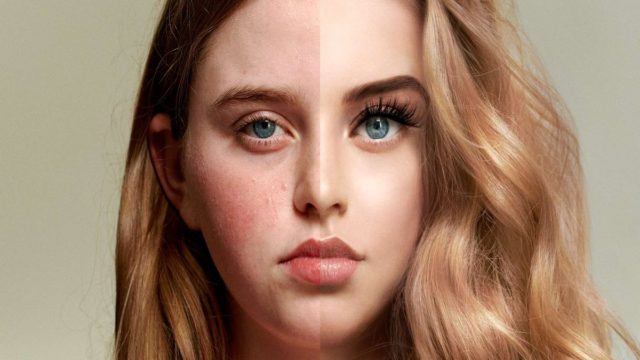 “SELFIE SELF ESTEEM”: Οι πιέσεις στα μέσα κοινωνικής δικτύωσης  οδηγούν τα κορίτσια παγκοσμίως να διαστρεβλώνουν την εμφάνισή τους στο Διαδίκτυο