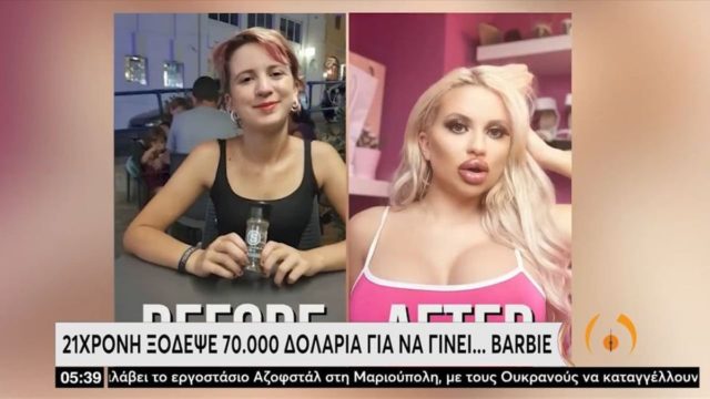 Αδιανόητο: 21χρονη ξόδεψε 70.000 δολάρια για να γίνει… Barbie
