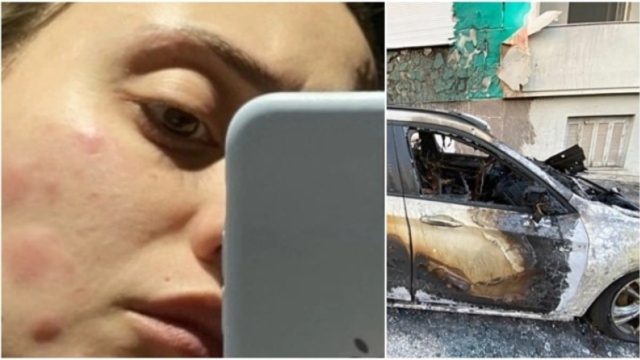 Σοκάρει η Άννα Κορακάκη με τον 34χρονο εμμονικό που είχε γίνει σκιά της: «Έτσι βίωσα το stalking – Είναι ό,τι πιο “ωμό” έχω αναρτήσει…» (photos)