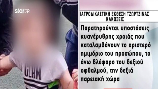 Νεκρά παιδιά στην Πάτρα: Σημάδια σοκ στο πρόσωπο της Τζωρτζίνας – Ολόκληρη η ιατροδικαστική έκθεση για την 9χρονη (Video)
