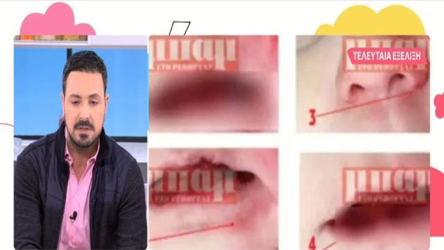 Αποκαλυπτικός ο Πέτρος Κουσουλός: Όλη η αλήθεια για τις φωτογραφίες της Ίριδας – «Είπαν ότι έχω κάνει photoshop, ότι πλήρωσα για να τις πάρω…» (Video)