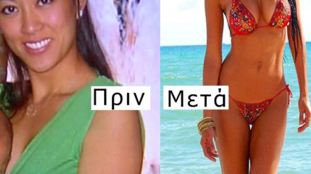 Πλαστικός χειρούργος μεταμόρφωσε τη γυναίκα του από την κορυφή ως τα νύχια κάνοντας την «κινητή διαφήμιση» της δουλειάς του!