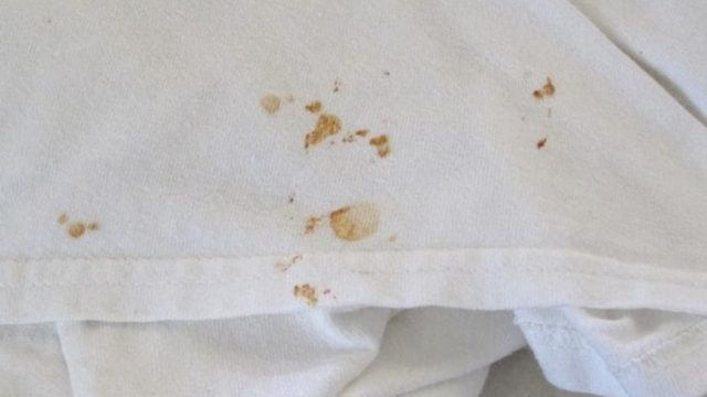 «Δαιμόνια» σκουριά στα ρούχα: Το μυστικό για να απομακρύνετε την και να πάψει η ταλαιπωρία!