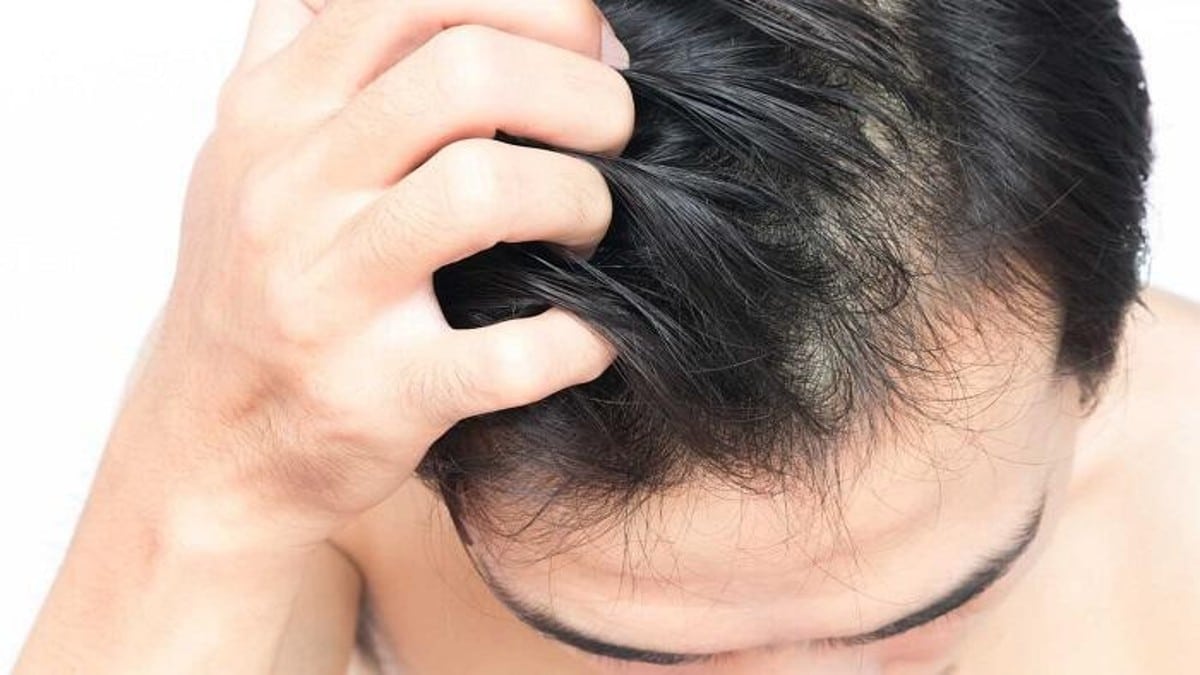 Τέρμα στην πτώση των μαλλιών: Φτιάξτε τη θαυματουργή φυσική μάσκα με ελαιόλαδο και κανέλα!