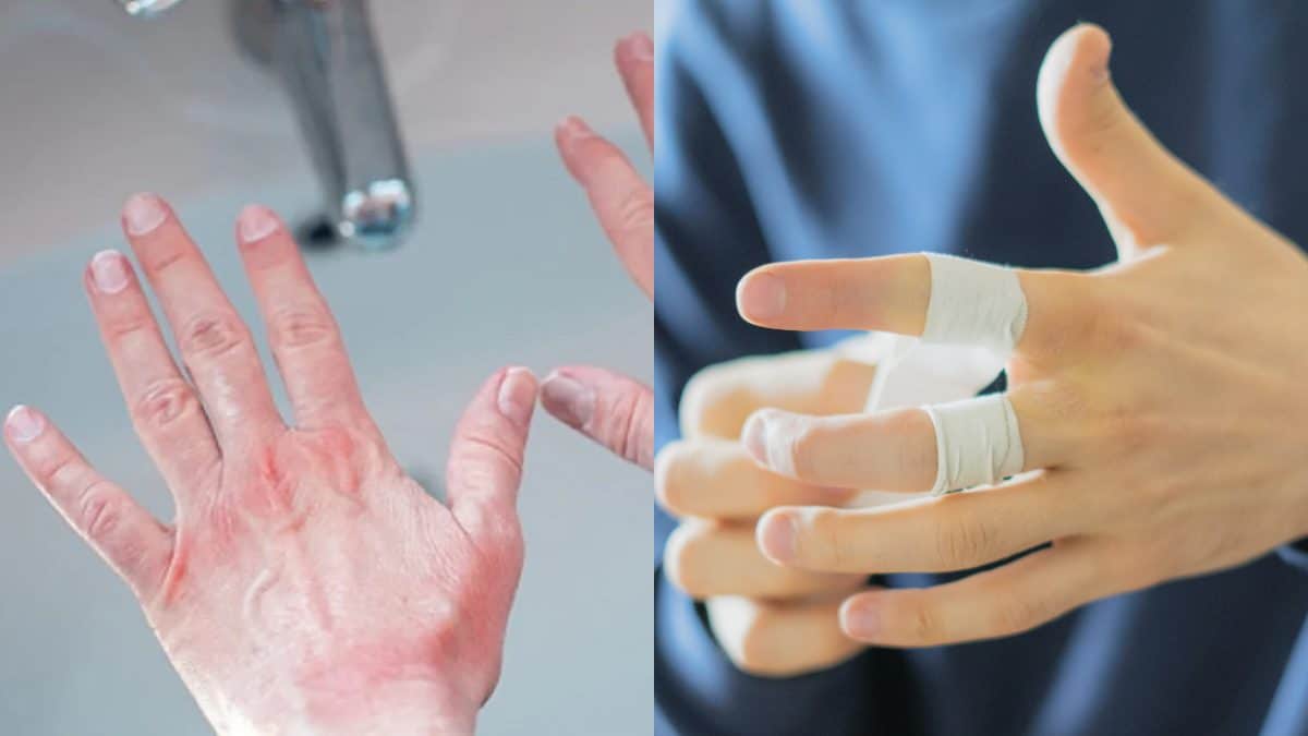 Πονούσε το δάχτυλό της πάνω από 40 χρόνια – Όταν έκανε τεστ οι γιατροί έπαθαν σοκ με αυτό που είδαν